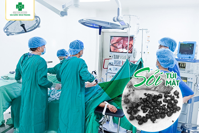 Bệnh viện đa khoa sài gòn nha trang vừa phẫu thuật nội soi cắt túi mật chứa hàng trăm viên sỏi