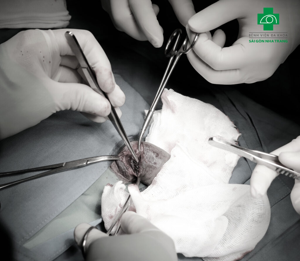 Phẫu thuật khâu phục hồi bao trắng vật hang cho bệnh nhân gặp sự cố gãy dương vật